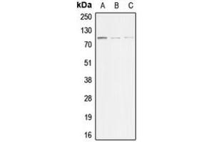 Image no. 2 for anti-Actinin, alpha 3 (ACTN3) (N-Term) antibody (ABIN2707305)