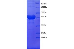 Image no. 1 for Histone H2B Type 1-C/E/F/G/I (LOC100407767) (AA 2-125) protein (GST tag) (ABIN5712177)