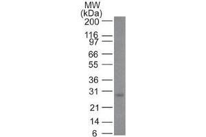 Image no. 5 for anti-B-Cell CLL/lymphoma 2 (BCL2) (AA 41-54) antibody (ABIN6940492)