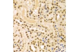 Immunohistochemistry of paraffin-embedded Mouse kidney using DKC1 antibody at dilution of 1:100 (x400 lens).