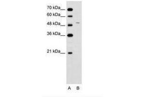Image no. 2 for anti-Ferrochelatase (FECH) (AA 51-100) antibody (ABIN6736623)