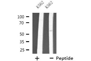 Image no. 3 for anti-Cytochrome P450, Family 2, Subfamily D, Polypeptide 6 (CYP2D6) antibody (ABIN6258044)