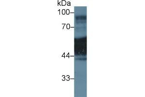 Image no. 2 for anti-Keratin 1 (KRT1) (AA 350-488) antibody (ABIN1172987)