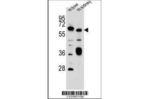 anti-Solute Carrier Family 2 (Facilitated Glucose Transporter), Member 13 (SLC2A13) (AA 268-297) antibody