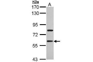 Image no. 2 for anti-Transducin (Beta)-Like 1 X-Linked Receptor 1 (TBL1XR1) (Center) antibody (ABIN2856777)