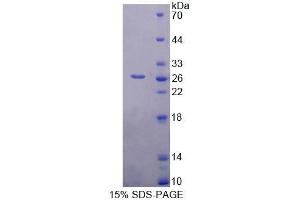 Image no. 1 for BCL2-Associated Athanogene (BAG1) (AA 177-358) protein (T7 tag,His tag) (ABIN6239585)