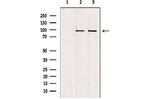 Image no. 1 for anti-NOP2/Sun Domain Family, Member 2 (NSUN2) (Internal Region) antibody (ABIN6263746)