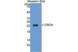 Image no. 1 for anti-Interleukin 12 Receptor beta 1 (IL12RB1) (AA 37-234) antibody (ABIN1174856)