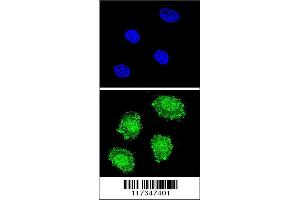 Image no. 3 for anti-Suppressor of Cytokine Signaling 1 (SOCS1) (AA 35-66), (N-Term) antibody (ABIN652738)