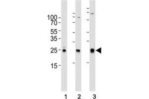 Western blot analysis of lysate from (1) human A431, (2) mouse NIH3T3, (3) rat C6 cell line using RAC1 antibody at 1:1000.