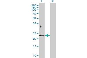 Image no. 1 for anti-Betacellulin (BTC) (AA 1-178) antibody (ABIN513828)