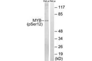 Western blot analysis of extracts from HeLa cells treated with Hu 2nM 24h, using MYB (Phospho-Ser12) Antibody.