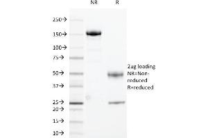 Image no. 1 for anti-HLA Class II DR alpha (HLA-DRA) antibody (ABIN6939637)