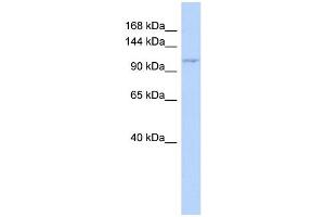 Image no. 1 for anti-Zinc Finger CCCH-Type Containing 7B (ZC3H7B) (Middle Region) antibody (ABIN2777440)