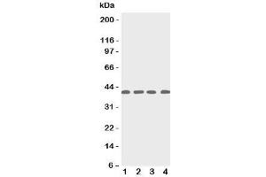 Western blot testing of p53R2 antbody; Lane 1: rat thymus;  2: human MCF-7;  3: (h) A431;  4: (h) HeLa cell lysate.