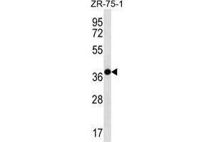Image no. 2 for anti-Tenomodulin (TNMD) (AA 220-249), (Middle Region) antibody (ABIN955144)