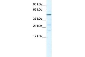 Image no. 1 for anti-Heat Shock Transcription Factor, Y-Linked 1 (HSFY1) (N-Term) antibody (ABIN925802)