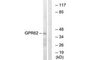 Image no. 1 for anti-G Protein-Coupled Receptor 62 (GPR62) (AA 181-230) antibody (ABIN1535747)