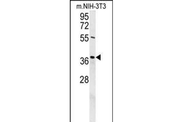 EXO5 antibody  (AA 166-193)