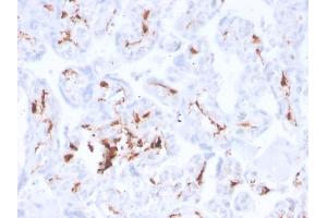 Image no. 2 for anti-Coagulation Factor XIII, A1 Polypeptide (F13A1) (AA 46-181) antibody (ABIN6939364)