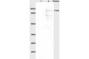 Image no. 3 for anti-Poly (ADP-Ribose) Polymerase 1 (PARP1) (AA 201-300) antibody (ABIN677903)