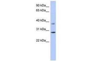 Image no. 1 for anti-Homeobox C5 (HOXC5) (C-Term) antibody (ABIN6742851)