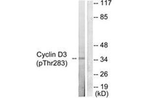 Image no. 2 for anti-Cyclin D3 (CCND3) (AA 243-292), (pSer283) antibody (ABIN1531266)
