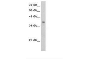 Image no. 1 for anti-V-Set and Immunoglobulin Domain-Containing Protein 4 (VSIG4) (AA 92-141) antibody (ABIN203399)