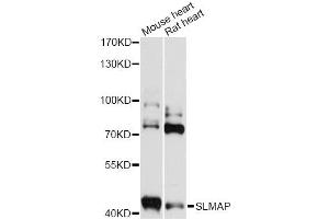 Image no. 1 for anti-Sarcolemma Associated Protein (SLMAP) antibody (ABIN6293579)