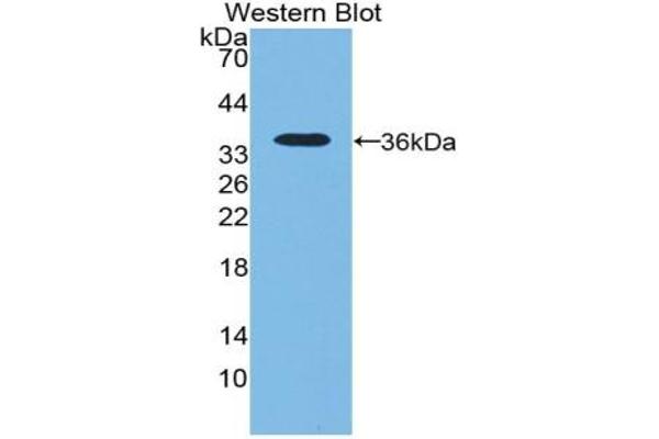 NT5C3 抗体  (AA 52-336)