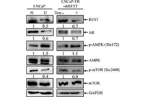 Image no. 111 for anti-Glyceraldehyde-3-Phosphate Dehydrogenase (GAPDH) (Center) antibody (ABIN2857072)