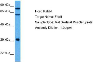 Image no. 7 for anti-FOS-Like Antigen 1 (FOSL1) (Middle Region) antibody (ABIN2777265)
