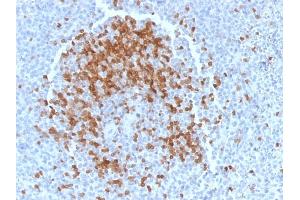 Image no. 3 for anti-T-Cell Leukemia/lymphoma 1A (TCL1A) (AA 2-109) antibody (ABIN6940948)
