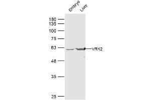 Image no. 1 for anti-Vaccinia Related Kinase 2 (VRK2) (AA 151-250) antibody (ABIN5675136)