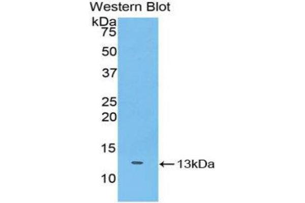 anti-Slit Homolog 3 (SLIT3) (AA 453-516) antibody