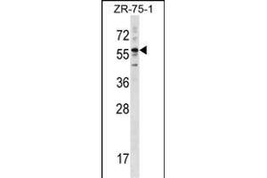 KRT3 Antibody (Center) (ABIN1538406 and ABIN2848455) western blot analysis in ZR-75-1 cell line lysates (35 μg/lane).