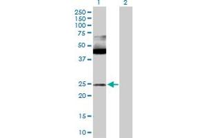 Image no. 1 for anti-MYC Associated Factor X (MAX) (AA 1-151) antibody (ABIN517750)
