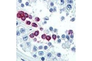 Image no. 2 for anti-Cyclin D1 (CCND1) (AA 68-97) antibody (ABIN3030588)