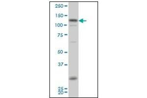 Image no. 3 for anti-Homeodomain Interacting Protein Kinase 2 (HIPK2) antibody (ABIN781914)
