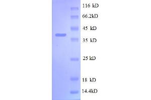 Image no. 1 for Ribosomal Protein S13 (RPS13) (AA 2-118) protein (GST tag) (ABIN5712606)