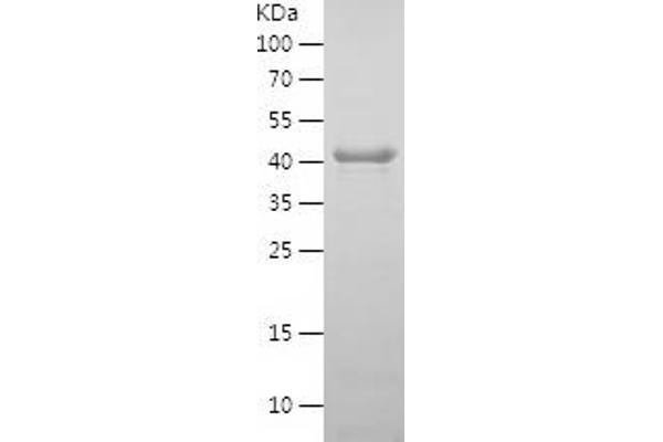 SIRT2 Protein (AA 2-389) (His tag)