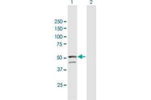 Western Blot analysis of GNAL expression in transfected 293T cell line by GNAL MaxPab polyclonal antibody.