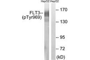 Image no. 1 for anti-Fms-Related tyrosine Kinase 3 (FLT3) (AA 935-984), (pTyr969) antibody (ABIN1532045)