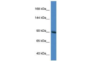 Image no. 1 for anti-RAS P21 Protein Activator (GTPase Activating Protein) 1 (RASA1) (C-Term) antibody (ABIN2777132)