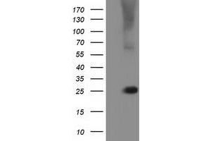 Image no. 1 for anti-RAB, Member of RAS Oncogene Family-Like 2A (RABL2A) antibody (ABIN1500577)