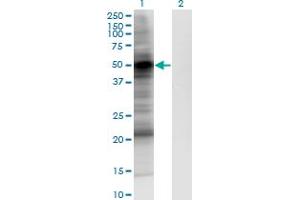 Image no. 2 for anti-3-phosphoinositide Dependent Protein Kinase-1 (PDPK1) (AA 457-556) antibody (ABIN950148)