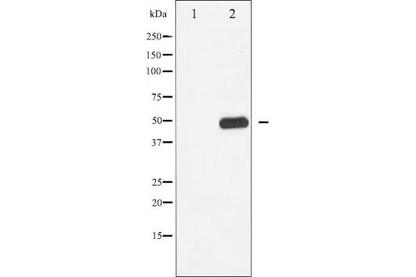 CAMK2B Antikörper  (pThr286)