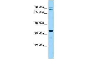 Image no. 1 for anti-Inositol(myo)-1(or 4)-Monophosphatase 2 (IMPA2) (C-Term) antibody (ABIN2787602)