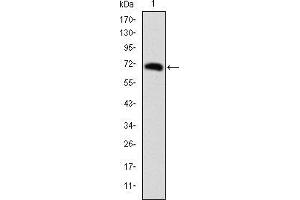 Image no. 2 for anti-Forkhead Box P2 (FOXP2) antibody (ABIN969154)