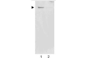 Image no. 4 for anti-Nestin (NES) (AA 1484-1500) antibody (ABIN104564)